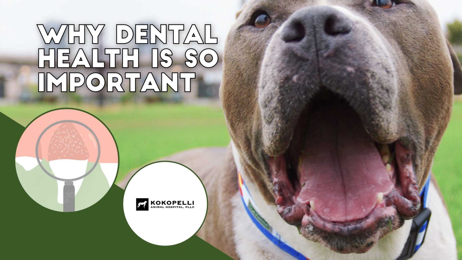 Why dental health is so important